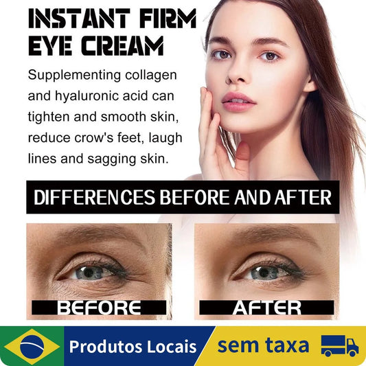 Celyn Eye Bag Cream , Instant Tightener Creme De Olhos Firme Instantâneo Para Círculos Escuros E Reduz O Puffiness , Linhas Fina