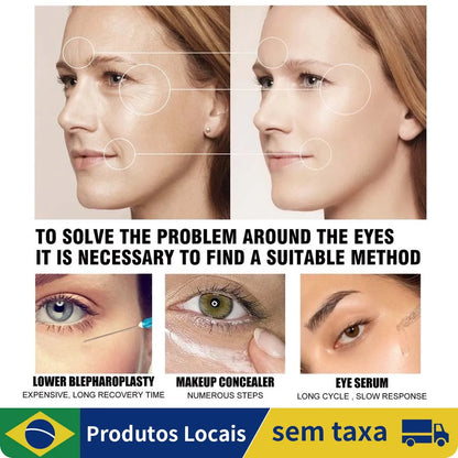 Celyn Eye Bag Cream , Instant Tightener Creme De Olhos Firme Instantâneo Para Círculos Escuros E Reduz O Puffiness , Linhas Fina