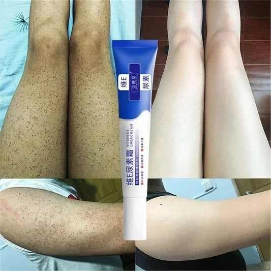 Curing Keratosis Pilaris Chicken Follicle Skin Repair Cream Body Dark Spot Remove Whitening Smooth Moisturize Skincare Body loti