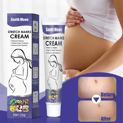 Pregnancy Stretch Repair Cream  Postpartum Wrinkle Removal  Mommy Cream  Fade Growth Lines And Obesity  Wrinkle Stretch Repair