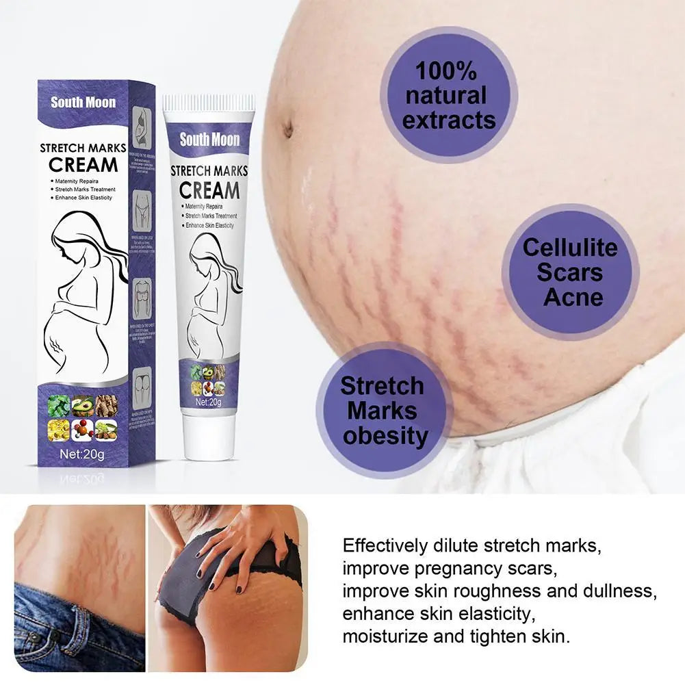 Pregnancy Stretch Repair Cream  Postpartum Wrinkle Removal  Mommy Cream  Fade Growth Lines And Obesity  Wrinkle Stretch Repair