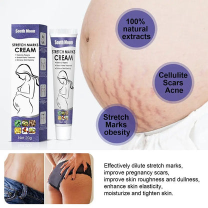 Pregnancy Stretch Repair Cream  Postpartum Wrinkle Removal  Mommy Cream  Fade Growth Lines And Obesity  Wrinkle Stretch Repair