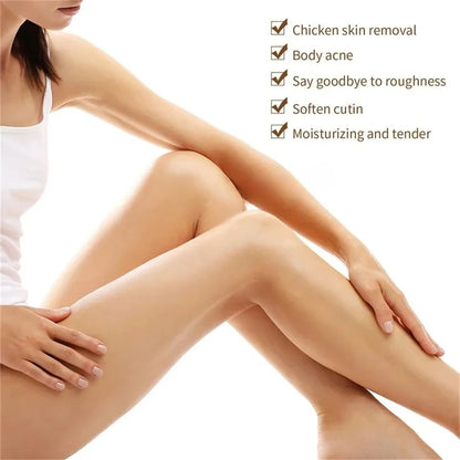 Curing Keratosis Pilaris Chicken Follicle Skin Repair Cream Body Dark Spot Remove Whitening Smooth Moisturize Skincare Body loti