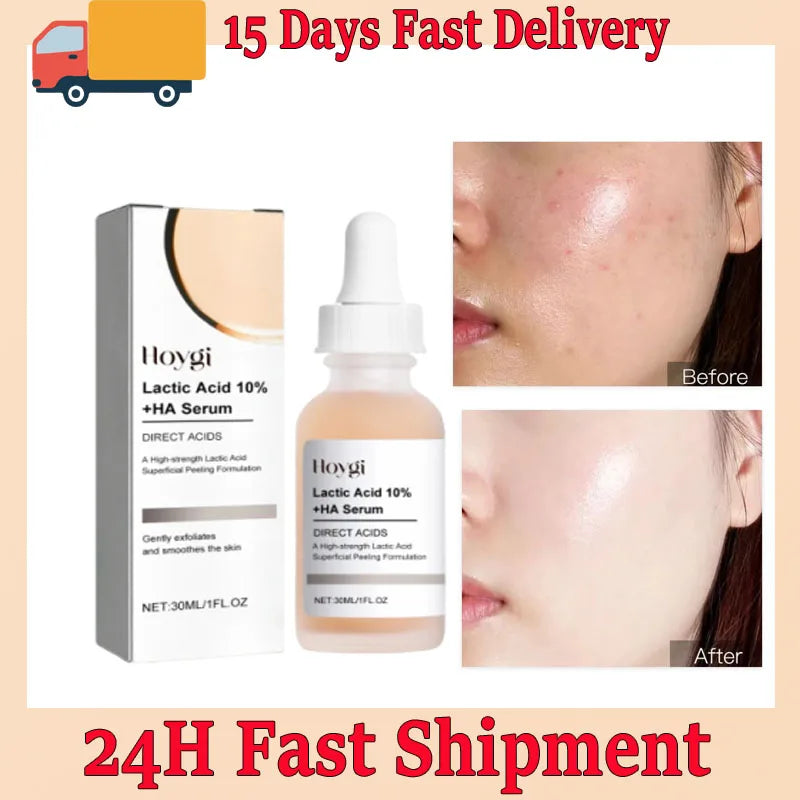 Lactic Acid Large Pores Removal Serum Pore Shrinking Minimizing Essence Moisturizing Firming Smooth Repair Korean Skin Care