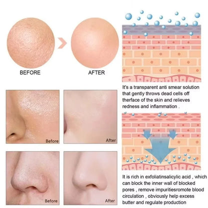 Lactic Acid Large Pores Removal Serum Pore Shrinking Minimizing Essence Moisturizing Firming Smooth Repair Korean Skin Care