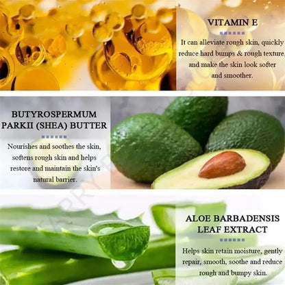 Curing Keratosis Pilaris Chicken Follicle Skin Repair Cream Body Dark Spot Remove Whitening Smooth Moisturize Skincare Body loti